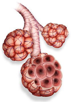 diagram of constricted alveoli